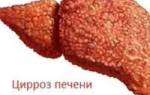 Можно ли вылечить цирроз печени