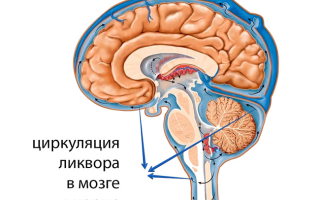 Можно ли вылечить внутричерепное давление
