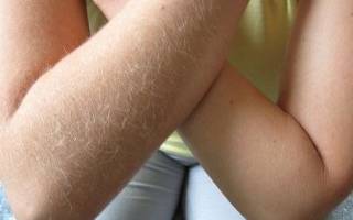 Можно ли удалять волосы на руках