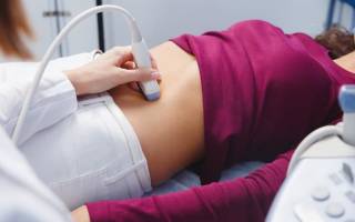 Можно ли удалять полип во время месячных