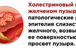 Холестериновый полип желчного пузыря можно ли вылечить