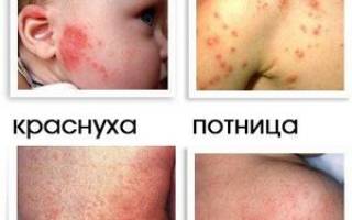 Можно ли детям валидол