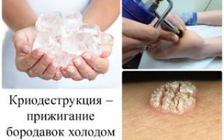 Можно ли купить жидкий азот в аптеке