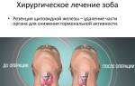 Можно ли вылечить зоб