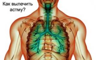 Можно ли вылечить астму