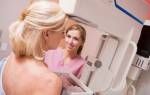 Можно ли делать маммографию во время месячных
