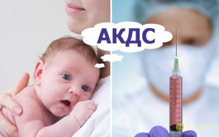 Можно ли делать акдс при аллергии