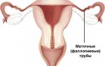 Удалили маточную трубу можно ли забеременеть