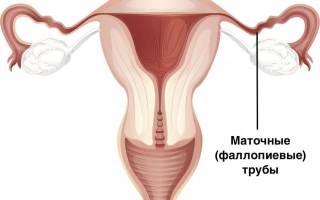 Удалили маточную трубу можно ли забеременеть