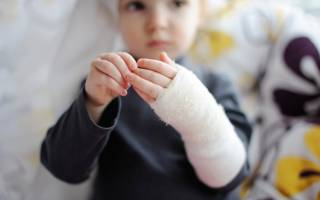 Можно ли делать рентген детям