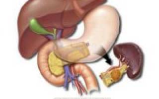 Можно ли удалить поджелудочную железу