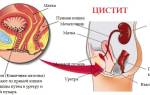 Можно ли пить при цистите