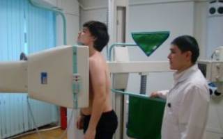 Можно ли делать флюорографию