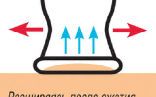 Можно ли ставить банки при пневмонии