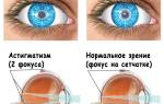 Можно ли вылечить астигматизм