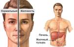 Можно ли вылечить синдром жильбера