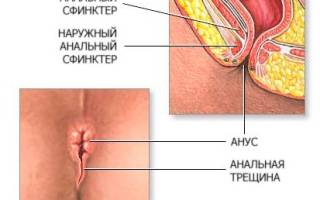 Можно ли получить удовольствие от анального секса