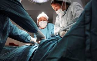 Можно ли удалять лимфоузлы