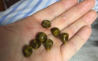 Можно ли удалить камень из желчного пузыря